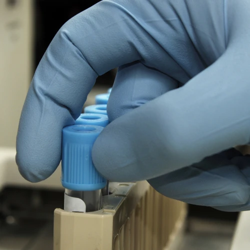 Imagen de: TIEMPO DE COAGULACIÓN