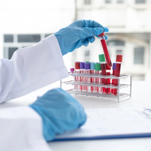 Imagen de: Biometría hemática