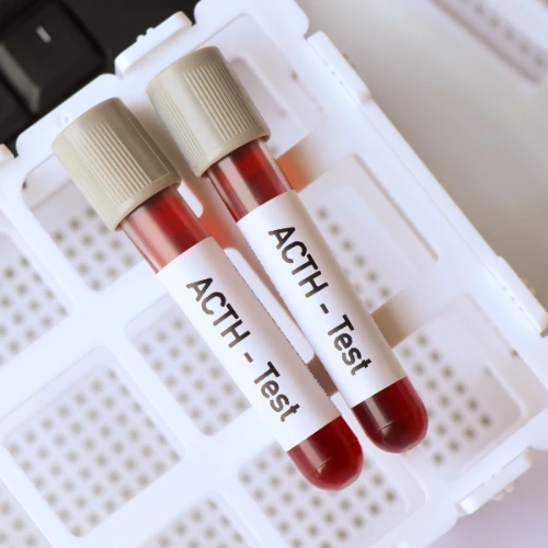 Imagen de: H. ADRENO CÓRTICO TRÓFICA (ACTH) 