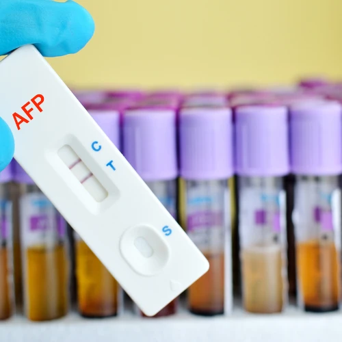 Imagen de: ALFA FETOPROTEINA (AFP)