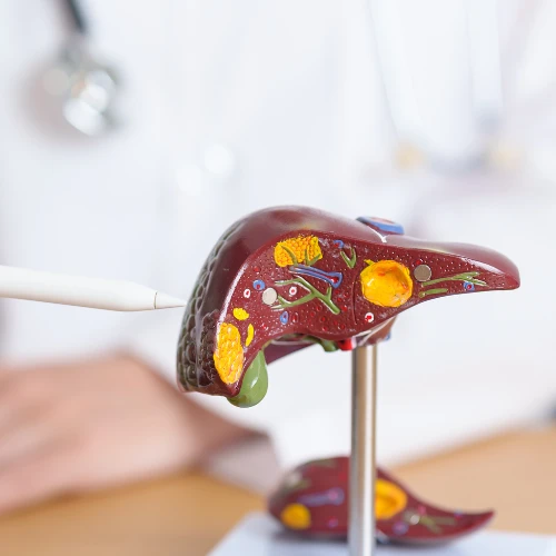 Imagen de: HEPATITIS VIRAL (VIRUS A+B+C)