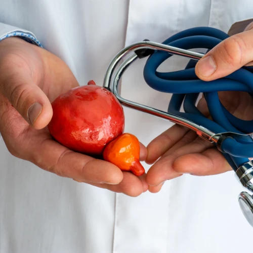 Imagen de: ANTÍGENO ESPECÍFICO DE  PROSTATA PSA TOTAL