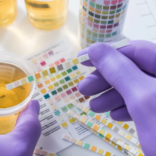 Imagen de: GENERAL DE ORINA