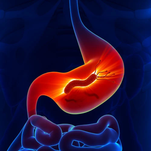 Imagen de: HELICOBACTER PYROLI IgG