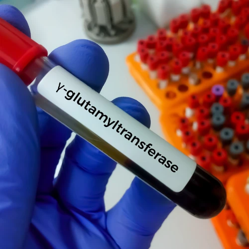 Imagen de: GAMMA GLUTAMIL TRANSFERASA