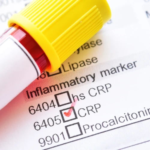 Imagen de: PROTEINA “C” REACTIVA