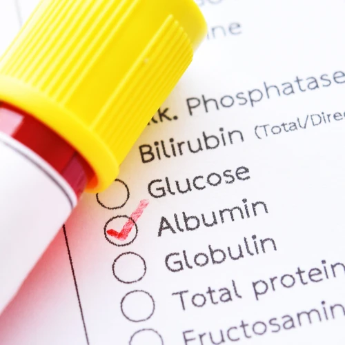 Imagen de: ALBÚMINA