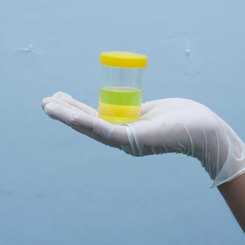 Imagen de: DEPURACIÓN DE CREATININA