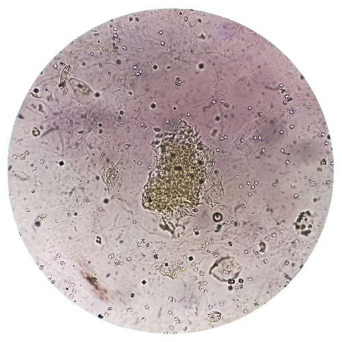 Imagen de: SED. ORINA