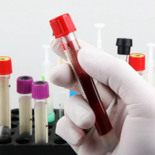 Imagen de: GLOBULINA